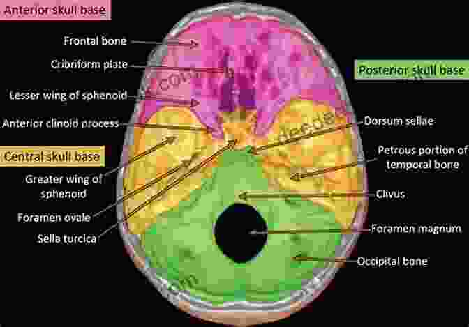 MRI Scan Of The Skull Base Skull Base Neuroimaging An Issue Of Neuroimaging Clinics Of North America E (The Clinics: Internal Medicine)