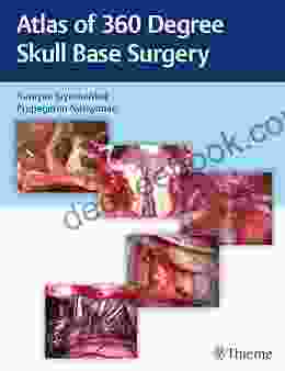 Atlas Of 360 Degree Skull Base Surgery