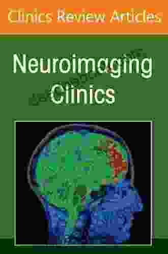 Skull Base Neuroimaging An Issue Of Neuroimaging Clinics Of North America E (The Clinics: Internal Medicine)